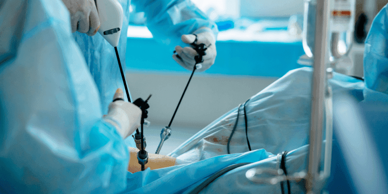 Laparoscopic Surgery Benefits and cost