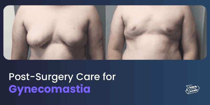 breast reduction treatment bangalore