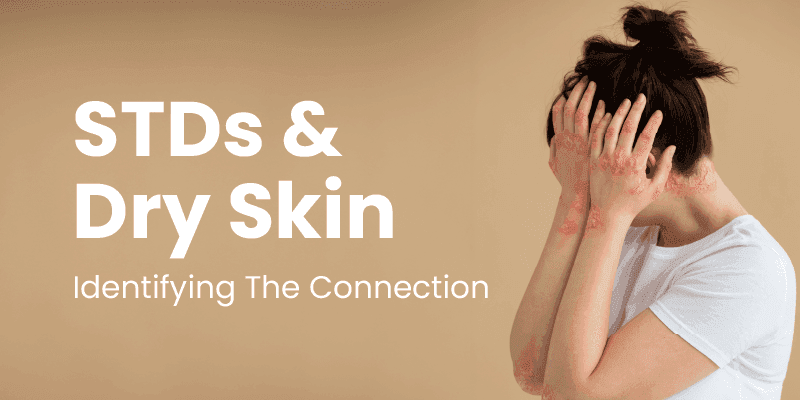 STDs and Dry Skin : Identifying the connection     