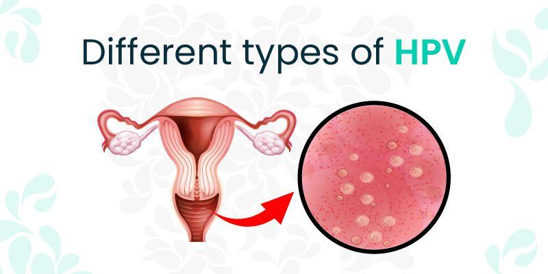 Types of HPV: High and Low Risk Strains